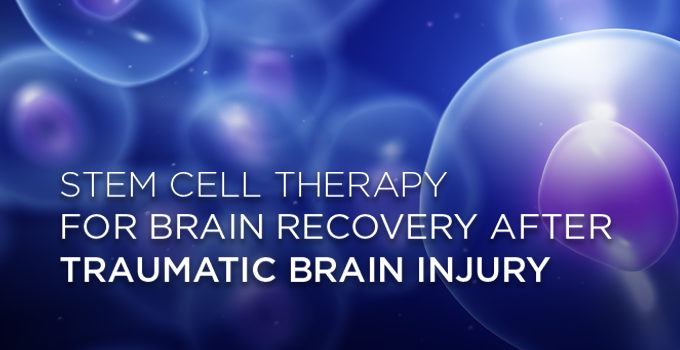 stem cell therapy banner