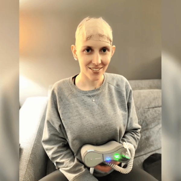 Guest Speaker Janice discusses what is it like to live with Optune (Tumor Treating Fields) for glioblastoma. The webinar was hosted by Akanksha Sharma, MD, Neuro-oncologist at the Pacific Brain Tumor Center at Pacific Neuroscience Institute.