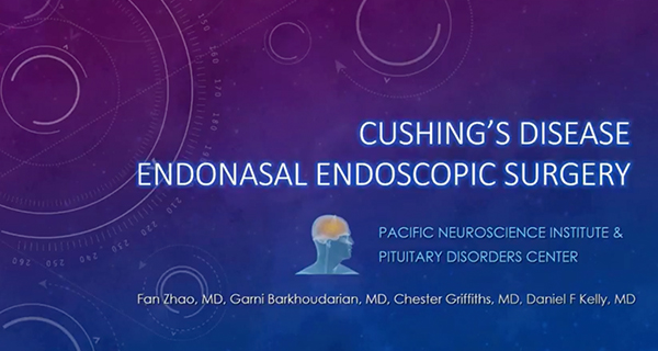 Cushing's Disease - Diagnosis and Treatment banner