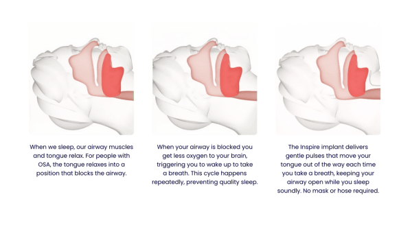 inspire infographic