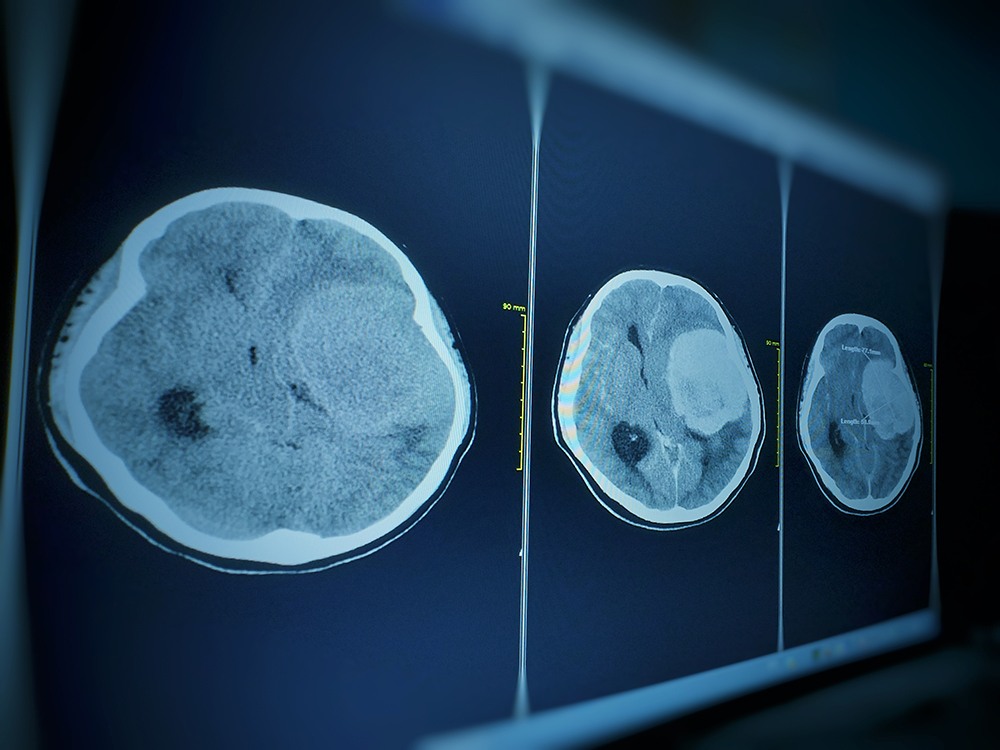 sample brain MRI scans