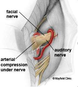 facial nerve